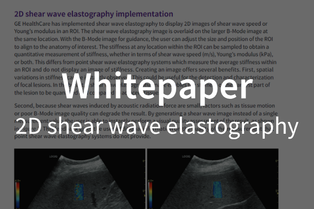Whitepaper / 2D Shear Wave Elastography
